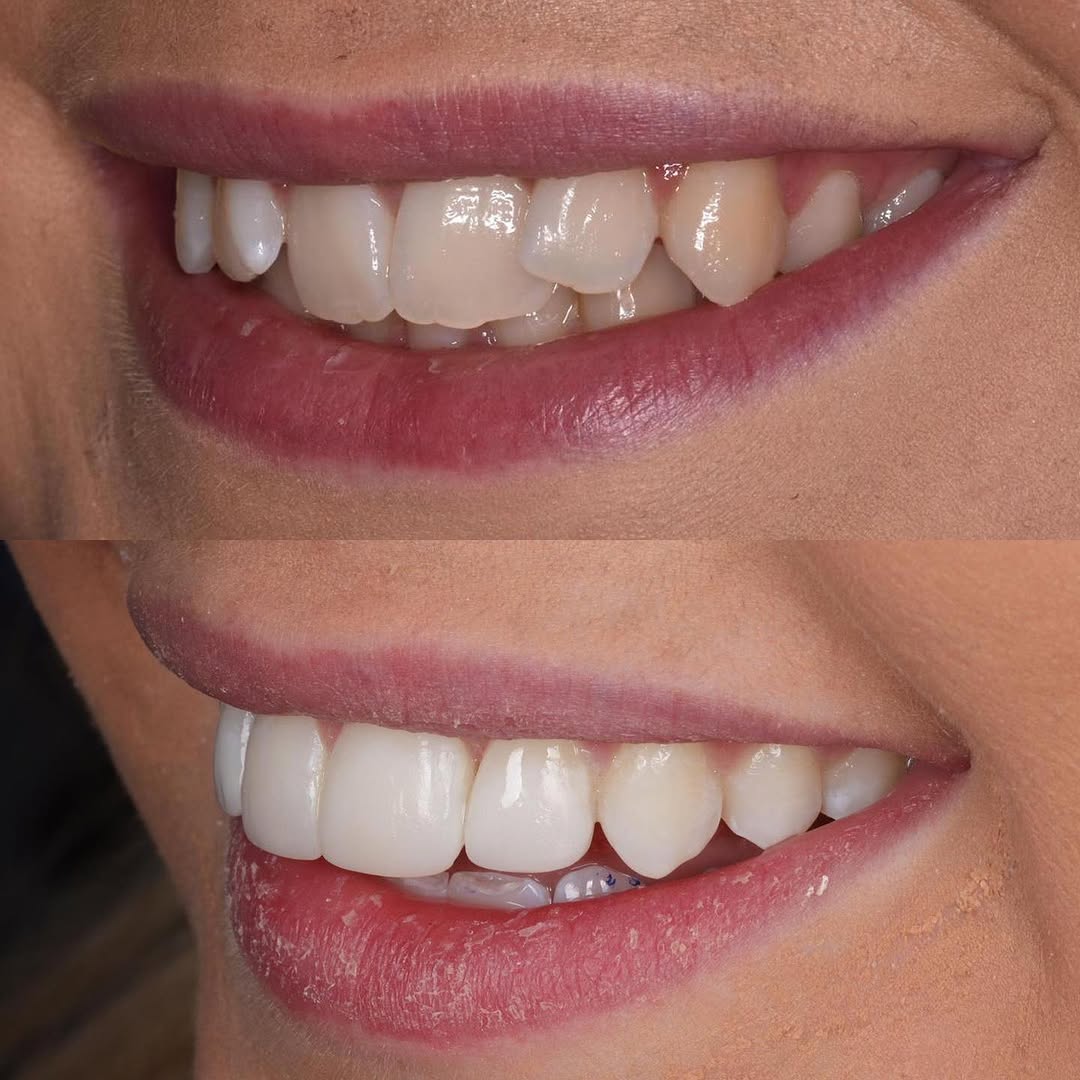 - The Dental Article Image gallery marquee