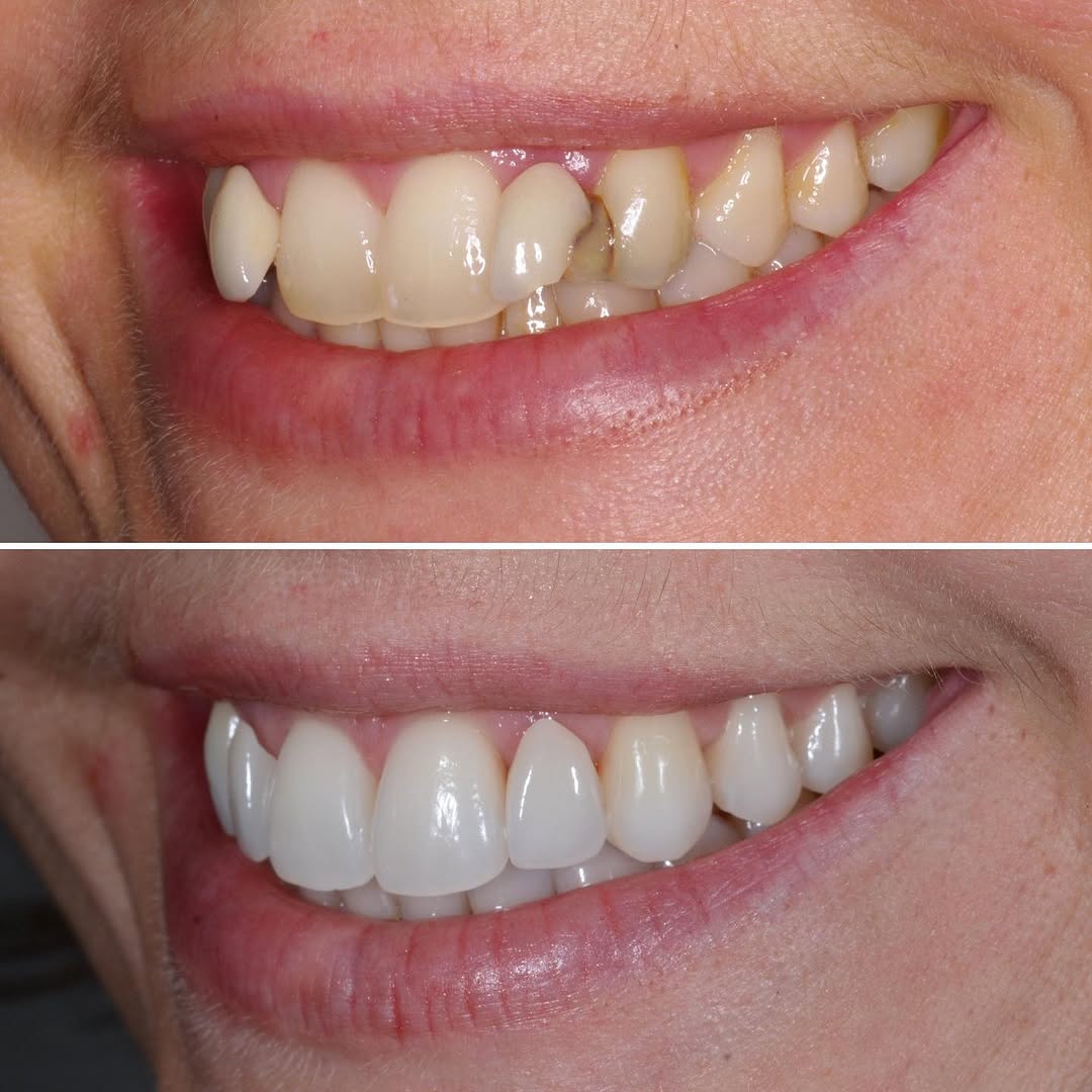 - The Dental Article Image gallery marquee