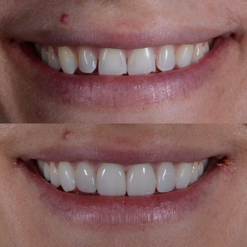 - The Dental Article WhatsApp Image 2026-03-15 at 15.38.48