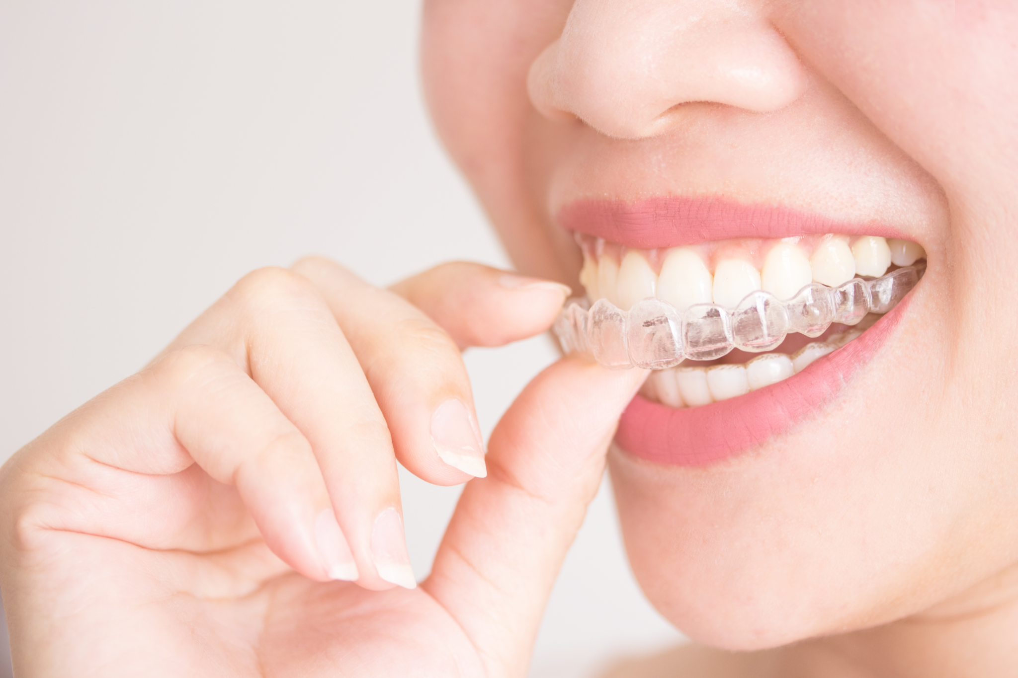 - The Dental Article https://cdn2.hubspot.net/hubfs/4845087/GSD-Straighten-Your-Teeth-with-Invisalign%C2%AE-Clear-Aligners-Blog.png