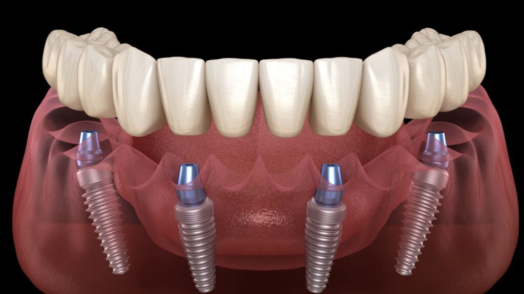 - The Dental Article WhatsApp Image 2026 05 10 at 15.03.21 - | The Dental Article